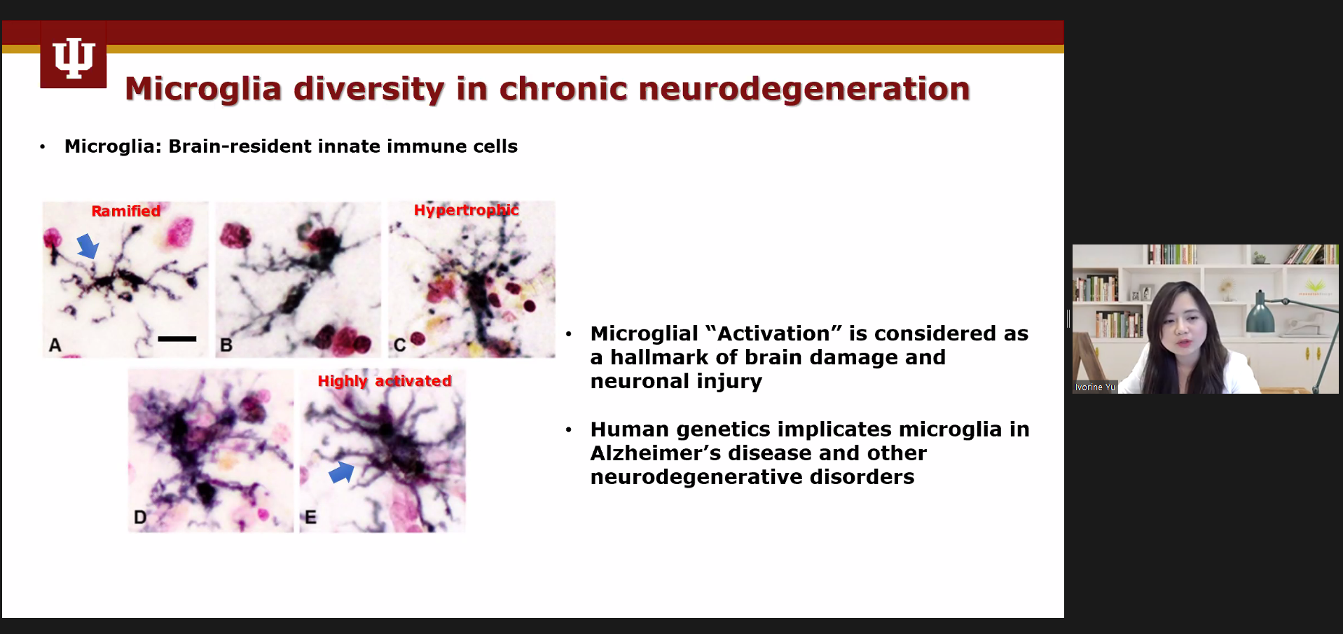 Ivorine Yu giving presentation about Single-cell transcriptome analysis reveals CNS innate immune landscape plasticity in diet-induced obesity and type 2 diabetes