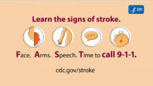 photos of stroke symptoms including face, arms, speech and time to call 911